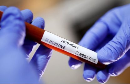 Новости о коронавирусной инфекции в Ставропольском крае по состоянию на 08 апреля 2020 года